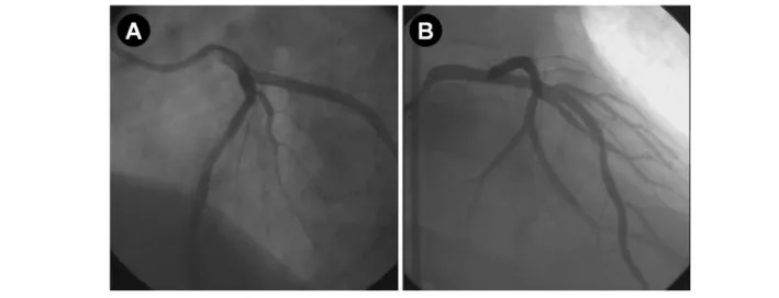 Fig. 3. A &amp; B, Final angiogram showed good distal flow without  residual stenosis