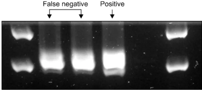 Fig. 2.  Re-testing  result  of  two  false  negative  cases  of  poly- poly-merase  chain  reaction-based  method  in  training  group  for  exon  19  mutations