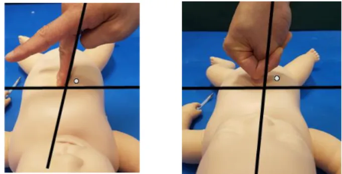 Fig.  3.  New  Chest  Compressions 