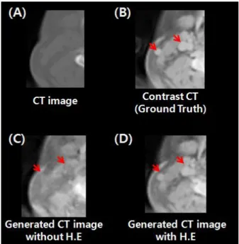 Fig.  4.  Represent  of  CT  and  contrast  enhanced  CT  image