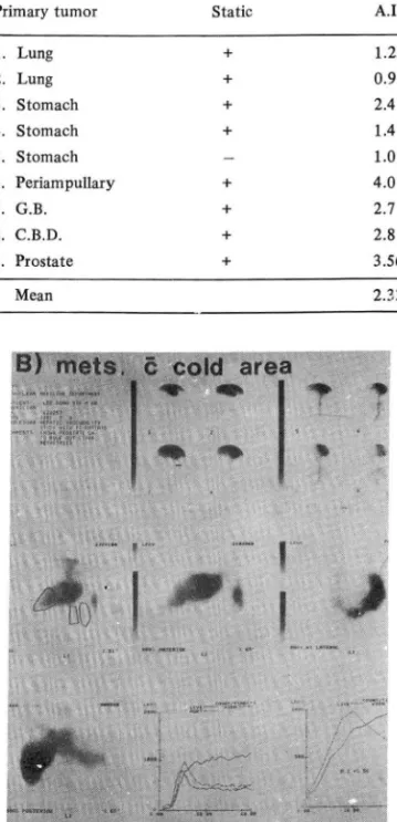 Fig . 7 은 정적영상에서  cold  area 가  있었던  경우， 