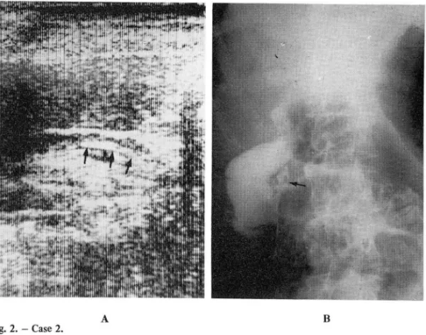 Fig.  3.  - Case 3. 