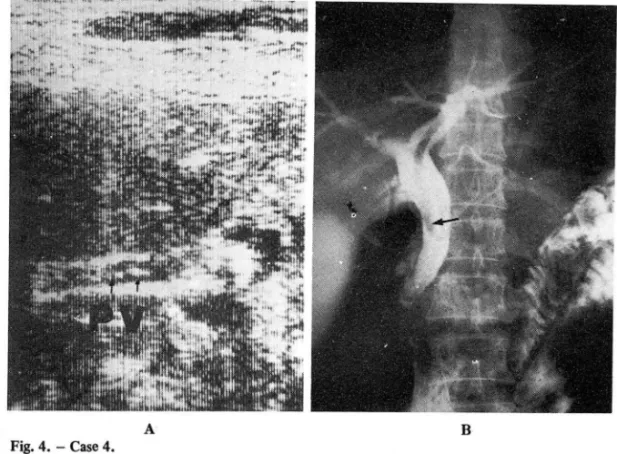 Fig. 5.  - Case  5. 