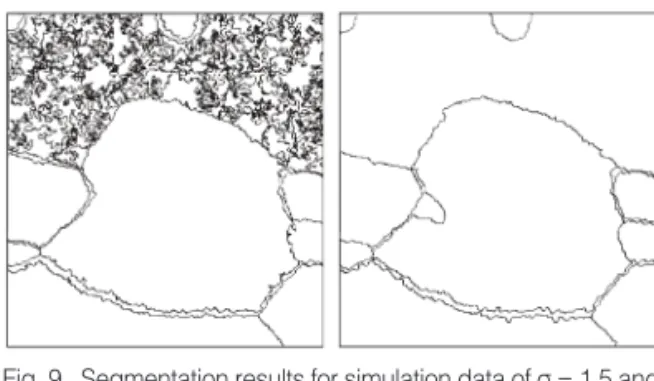 Fig. 9.  Segmentation results for simulation data of σ = 1.5 and SNR = 0.33: without image restoration (left) and with image restoration (right).