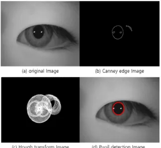 Fig.  2.  Pupil  detection  using  Hough  transform 