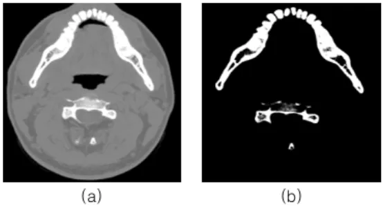 Fig.  7.  (a)  Jawbone  line  example  detected  approximately  (b)  Jawbone  curve  fitting  using 