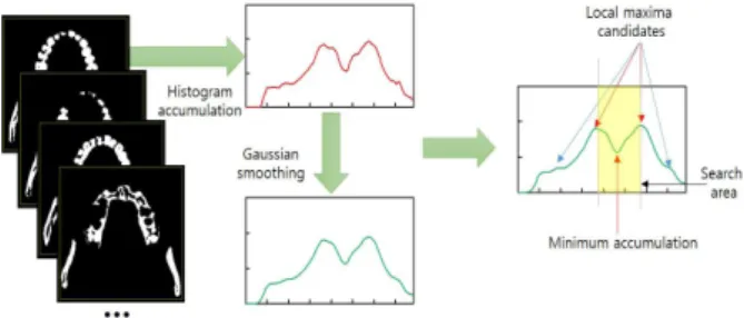 Fig.  9.  Setting  process  of  Panoramic  image  and  jawbone  curve  and  adjustment  range 
