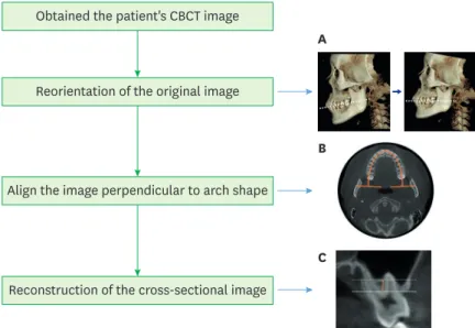 Figure 1 presents the overall workflow of this study. All CBCT images were obtained with  an Alphard 3030 device (Asahi Roentgen Ind