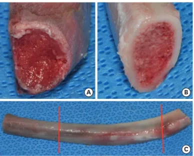 Figure 2. Bone type standardization. (A) Most of the proximal area showed D3- or D4-type bone morphology