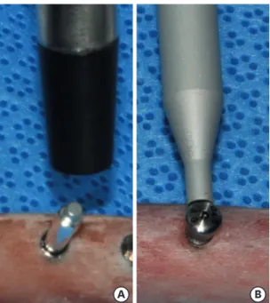 Figure 4. Implant stability testing. (A) With a resonance frequency analysis device. (B) With a damping capacity  analysis device.