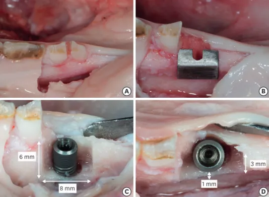 Figure 1. Extraction of the mesial root of the second premolar and preparation of the bone defect