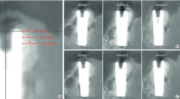 Figure 4. CBCT scan perpendicular to the implant axis before and after suturing. (A) Pre-suturing CBCT of groups 1, 2, and 3