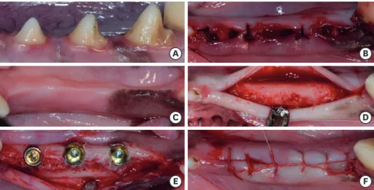 Figure 2. Clinical photographs from the present study. Before tooth extraction (A), after tooth extraction (B), 1  month after tooth extraction (C), horizontal incision and flap reflection (D), implant placement (E), suture with  5/0 Vicryl (F).