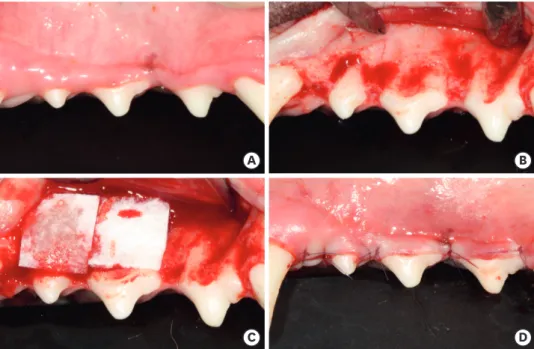 Figure 1. Clinical photographs of the surgical procedure. (A) Preoperative view of the first, second, and third  premolars