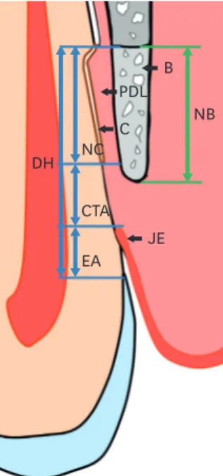 Figure 2. Schematic drawing of measurements. The bottom of the defect was set at the most apical point of the  planed root surface, the most coronal point of newly formed cementum on the root surface was marked by a  straight line, and the most apical poin