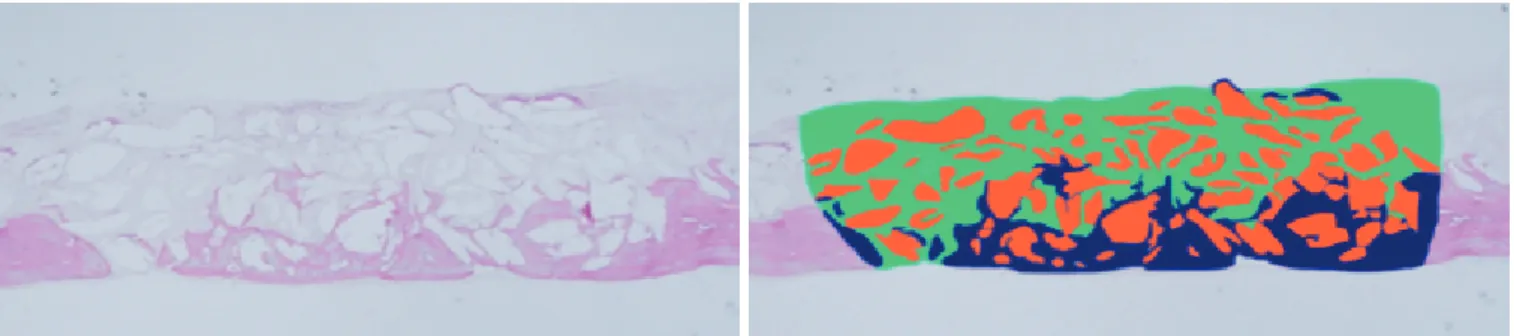 Figure 1. Method of measuring new bone, graft particles, and soft tissue area. Each slide was painted using Photoshop