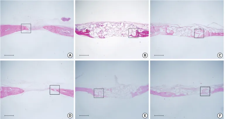 Figure 2. Histologic evaluation (hematoxylin and eosin staining). (A) NHBO-control group, (B) NHBO-BCP group, (C) NHBO-mBCP group, (D) HBO-control group,  (E) HBO-BCP group, (F) HBO-mBCP group