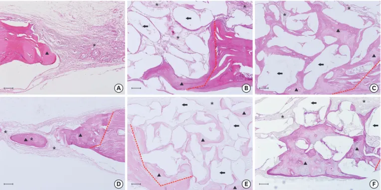 Figure 3. Histologic slides (hematoxylin and eosin staining) of the area of interest. (A) NHBO-control group, (B) NHBO-BCP group, (C) NHBO-mBCP group,  (D) HBO-control group, (E) HBO-BCP group, (F) HBO-mBCP group