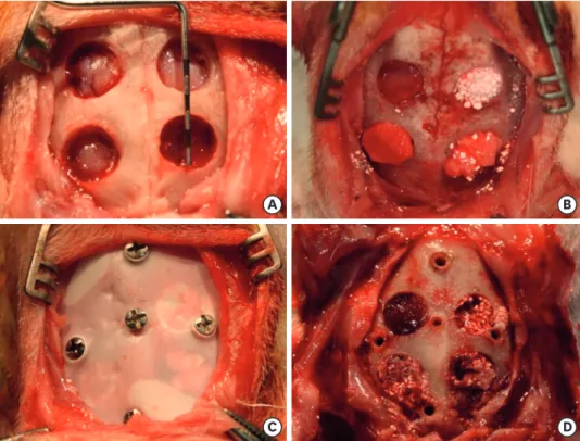 Figure 2. Surgical procedure. (A) Bone defects were made in the rabbit calvarium. A circular defect with a  diameter of 6 mm was formed in the skull