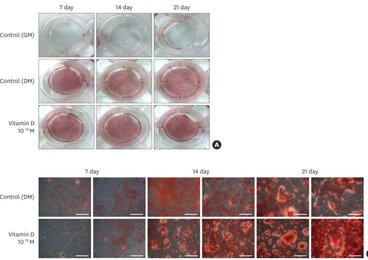 Figure 4. Effects of 1,25-dihydroxyvitamin D 3  on the formation of mineralized nodules in MC3T3-E1 cells