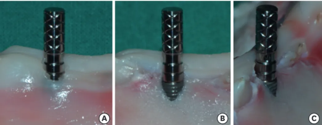 Figure 1. Implant fixture placement and parallel pin connection. A dehiscence defect was intentionally formed  and an implant fixture was placed in a porcine model without flap elevation (A)