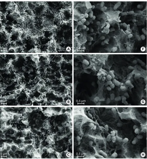Figure 2. Scanning electron microscopy images of Porphyromonas gingivalis cells attached to the sandblasted  large-grit acid-etched surface: (A, F) control group; (B, G) photodynamic therapy group; (C, H) brush alone  group; (D, I) brushing with a LED ligh