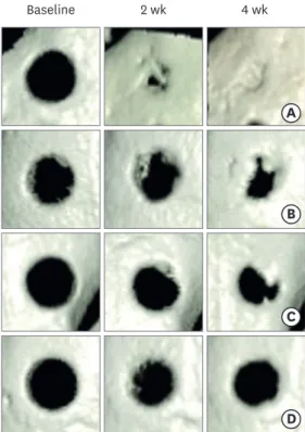 Figure 2. Reconstructed 3-dimensional cone-beam computed tomography image. The control group (A) showed  relatively rapid and prominent bone regeneration compared to groups 1 (B), 2 (C), and 3 (D).