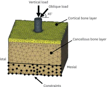 Figure 4. Meshed model of the artificial bone block with an axial implant. Vertical and 45° oblique loading were  simulated