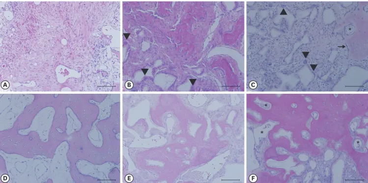 Figure 4. Histologic evaluation. (A) Negative control, 4 weeks: a large portion of the socket was composed of fibrous connective tissue