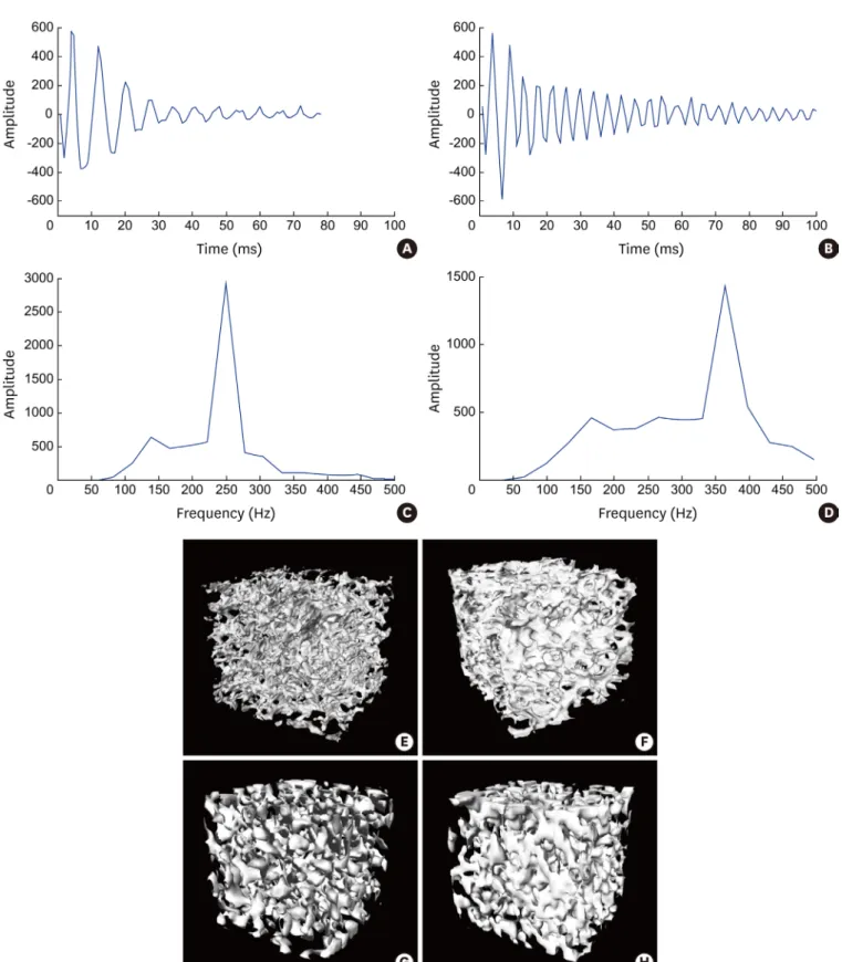 Figure 2. Examples of impulse response signals (A, B) and their power spectra (C, D) in two different bone samples, and CT images using micro-CT (E, F) and  using CBCT (G, H)