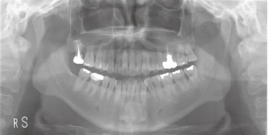 Figure 3. Panoramic radiography at the initial examination.