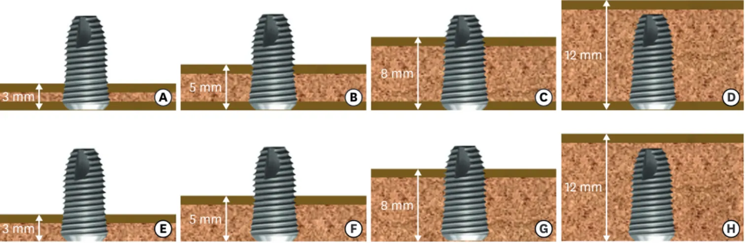 Figure 1. Schematic drawings of the designed models. The thin dark layers represent cortical bone layers of 1 mm in thickness