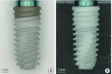 Figure 1. Comparison of the 2 types of implant coatings. (A) Partially hydroxyapatite (HA)-coated implant fixture  with resorbable blast medium on the coronal portion of the threads (2 mm)