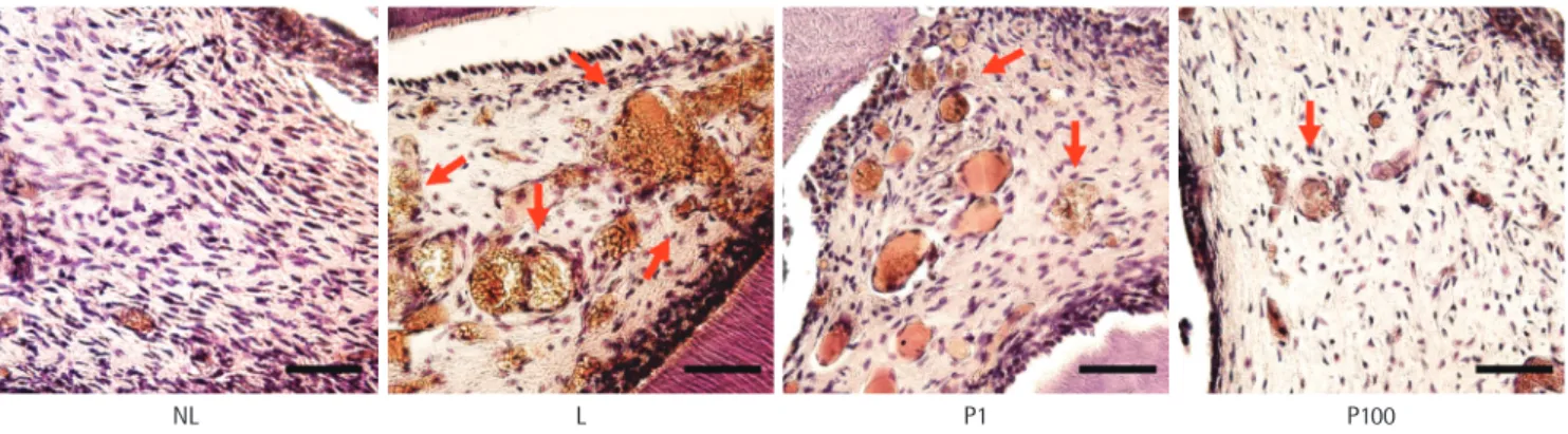 Figure 3. The effect of PerioH-035 on osteoclastic activity indicated by tartrate-resistant acid phosphatase (TRAP) staining