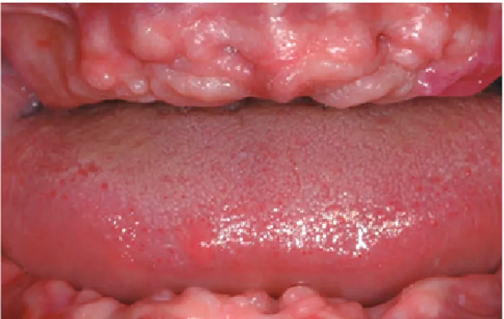 Figure 3.  Computer-aided planning in the lower jaw.