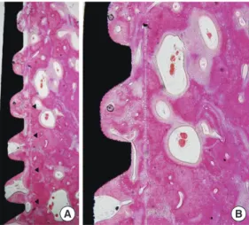 Figure 3.  Rotational implants group, 8-week healing period (H&amp;E, 