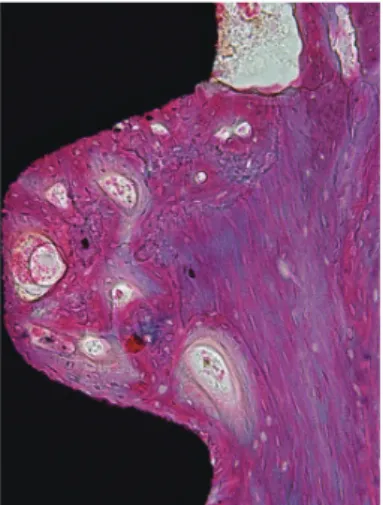 Figure 4.  Control group, 8-week healing period (H&amp;E,  ×200). Cell- Cell-rich bone marrow zone was seen.