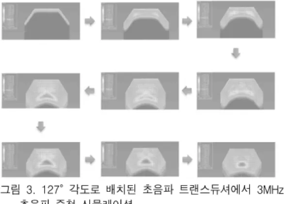 Fig.  3.  3MHz  ultrasound  simulation  nested  in  the  ultrasonic  transducers  arranged  in  a  127  °  angle