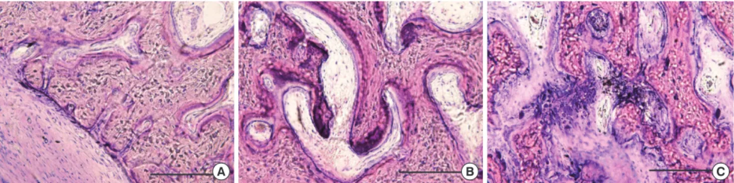 Figure 4. Alveolar bone images of each group (H&amp;E, bar=100 µm). (A) There was no sign of inflammation in the control