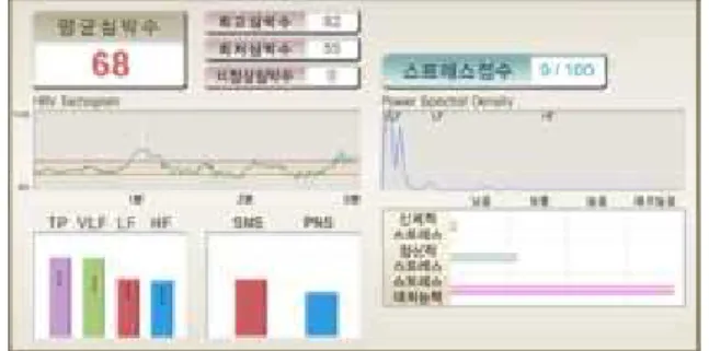 Fig.  13  Time  Domain  Analysis  before  and  after
