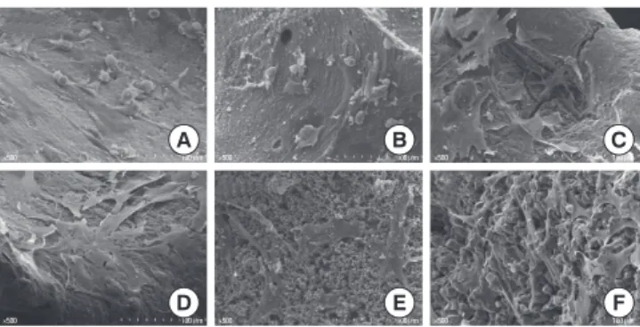 Figure 5. Scanning electron microscopy images showing cells on (A)  deproteinized bovine bone mineral (DBBM), (B) DBBM/fibronectin  (FN), (C) hydroxyapatite (HA), (D) HA/FN, (E) HA/tricalcium  phos-phate (TCP), and (F) TCP at day 7 (×500)