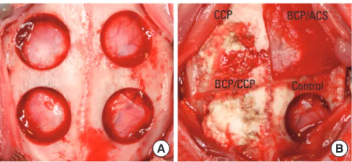 Figure 1.  Clinical photographs of defect preparation (A) and appli- appli-cation of the experimental materials (B)