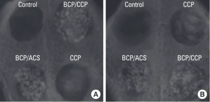 Figure 7.  Histologic presentation of the biphasic calcium phos- phos-phate (BCP)/absorbable collagen sponge group after 4 weeks of  healing