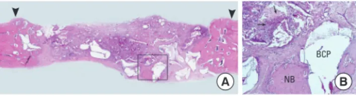 Figure 9.  Histologic presentation of the biphasic calcium phos- phos-phate (BCP)/cyanoacrylate-combined calcium phosphos-phate group  af-ter 4 weeks of healing