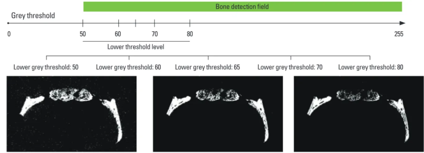 Figure 4.  Illustration and micro-computed tomography images according to the lower threshold level