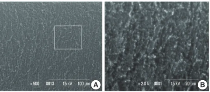 Figure 13.  The comparison from the oblique perspective ×2,000 (A)  control (B) 180 mJ/pulse, 10 Hz, 1.5 minutes.