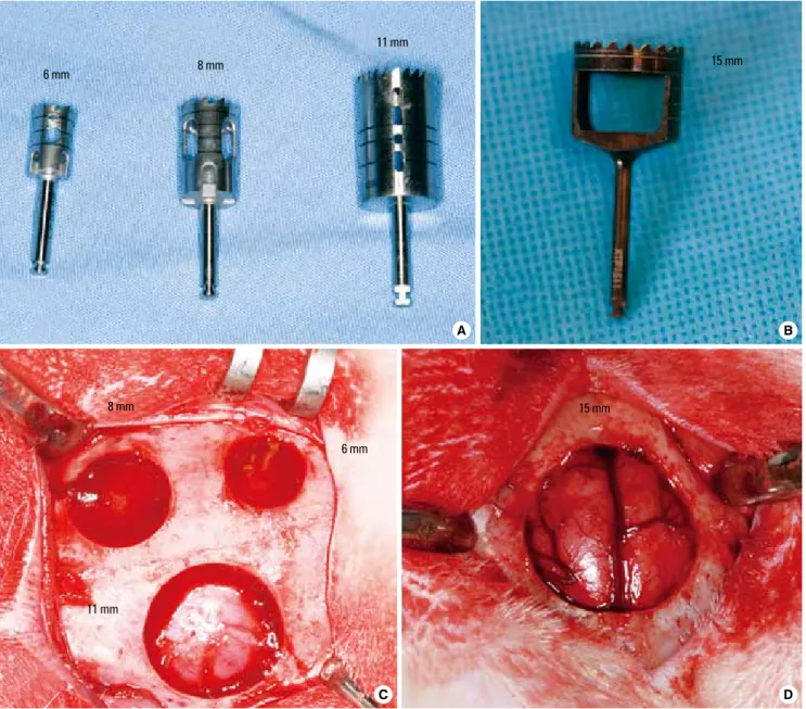 Figure 1.  Trephine burs and different sizes of defects (A) The trephines with outer diameters of 6, 8, and 11 mm