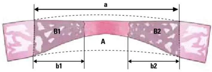 Figure 2.  Schematic diagram of a calvarial osteotomy defect show- show-ing the measurement parameters from which the followshow-ing  histo-metric parameters were determined (with linear and area  measure-ments in millimeters and millimeters squared, respe