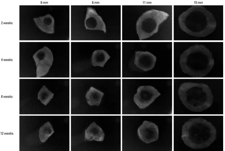 Figure 3.  Radiographic views of the surgical defects at different healing periods.