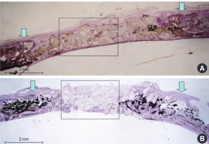 Figure 2.  (A) Histologic view of uncoated bone group after 4 weeks. 